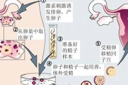 取出卵后阴道少量出血正不正常？持续多少天会消失？